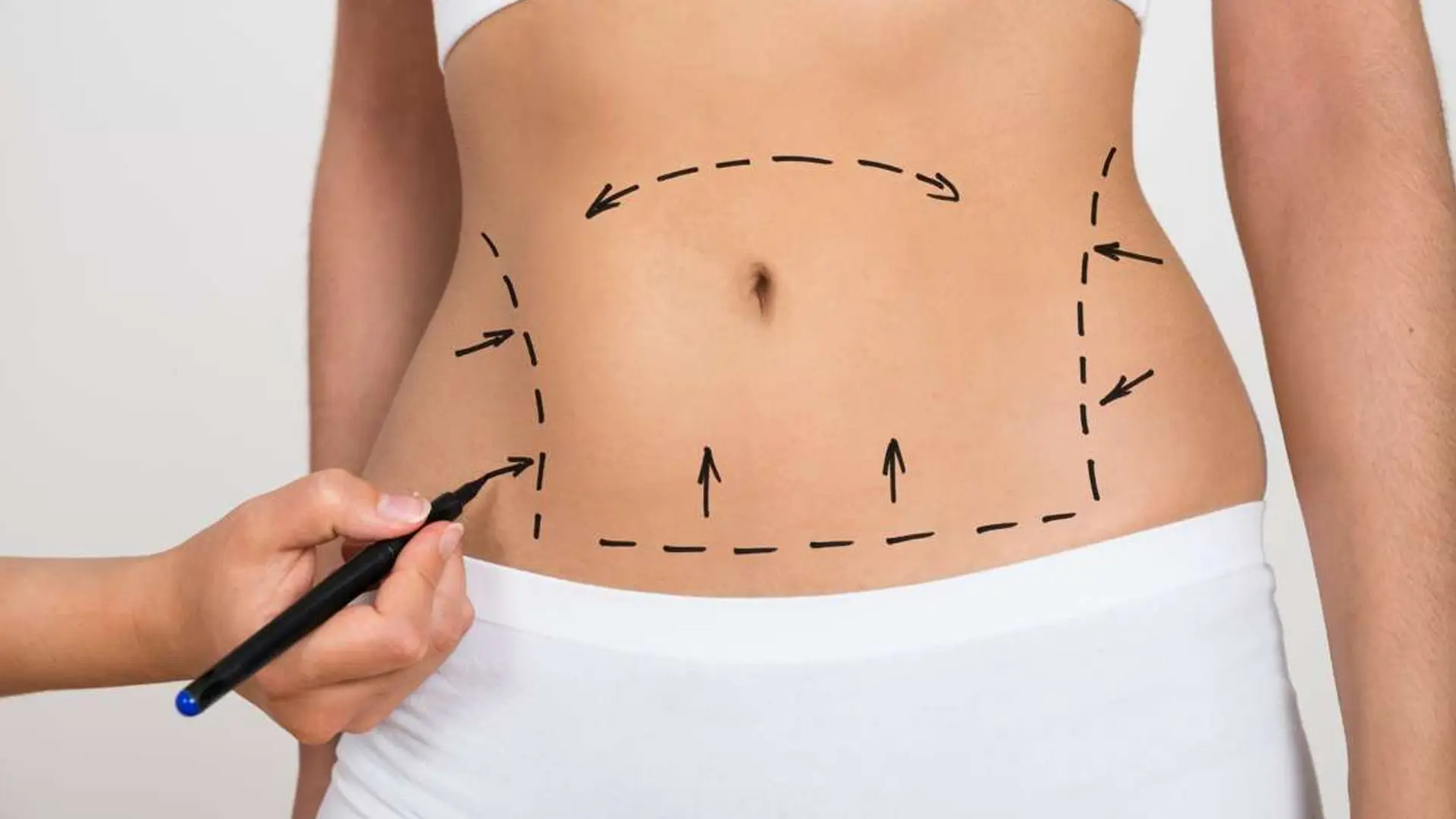 Body Contouring Surgery: What's Possible for a New Silhouette?